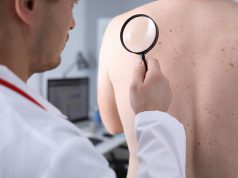 Jerawat Di Badan Mengganggu? Yuk Hilangkan Dengan Tips Berikut
