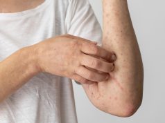 7 Cara Efektif Basmi Tungau di Rumah