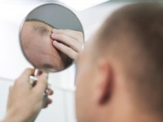 5 Faktor Penyebab Rambut Rontok Pada Pria dan Cara Mengatasinya 5 Faktor Penyebab Rambut Rontok Pada Pria dan Cara Mengatasinya