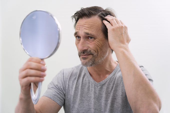 4 Cara Mengatasi Rambut Rontok Pada Pria