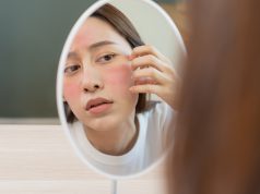 6 Penyebab Skin Barrier Rusak skin barrier rusak