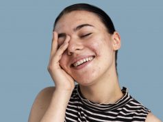 5 Cara Merawat Kulit Purging Agar Tetap Sehat merawat kulit purging